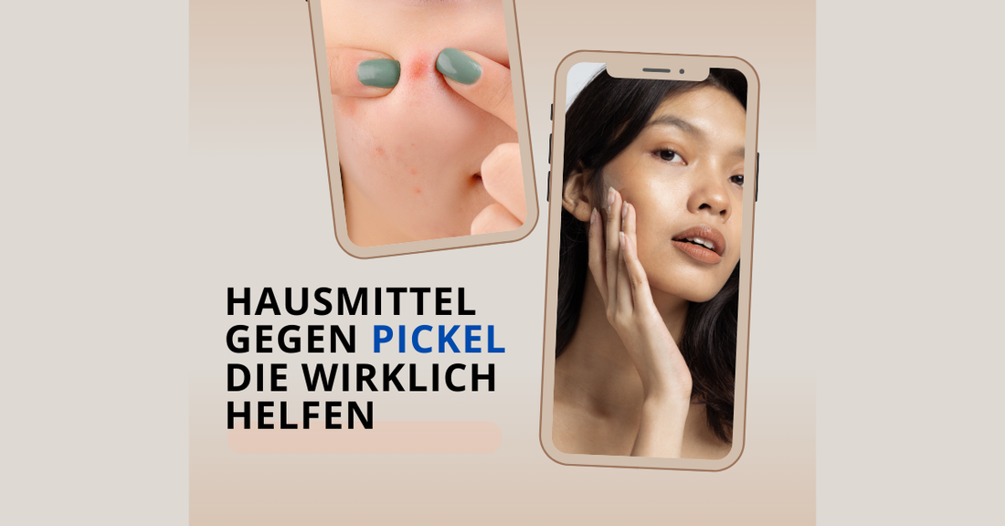 Zwei Smartphone-Ansichten mit Vorher-Nachher-Effekt: links entzündete Pickel, rechts reine Haut nach natürlicher Pflege – Hausmittel gegen Pickel, die wirklich helfen.