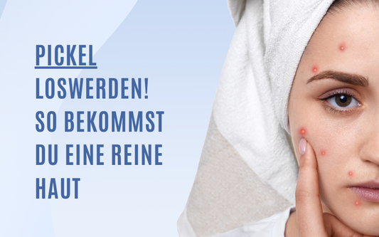 Pickel loswerden – effektive Tipps für eine reine Haut ohne Unreinheiten