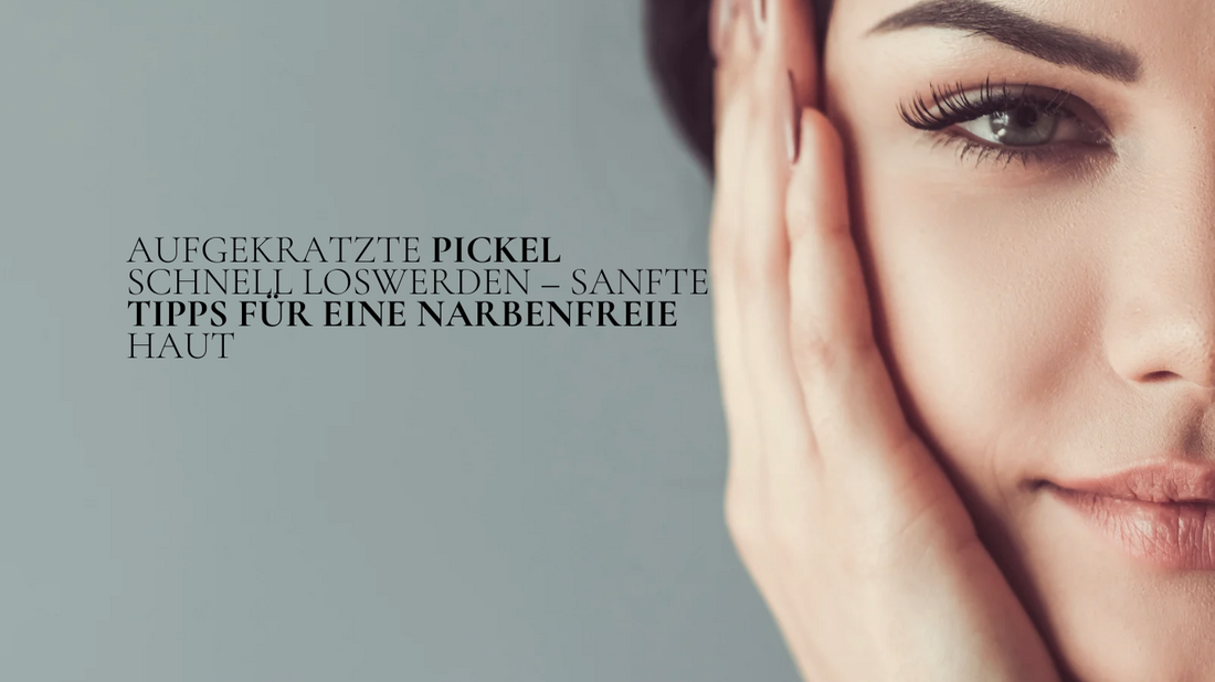 Frau berührt sanft ihr Gesicht – Tipps, um aufgekratzte Pickel schnell loszuwerden und Narben zu vermeiden