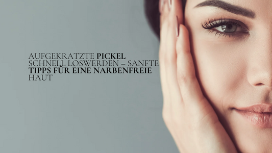 Frau berührt sanft ihr Gesicht – Tipps, um aufgekratzte Pickel schnell loszuwerden und Narben zu vermeiden